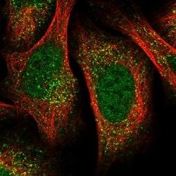 UBR1 Antibody, Novus Biologicals 0.1mL; Unlabeled:Antibodies, Polyclonal